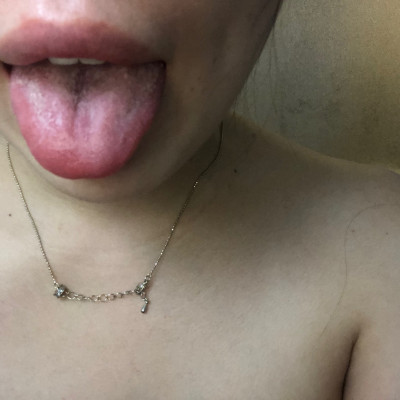 Tongue